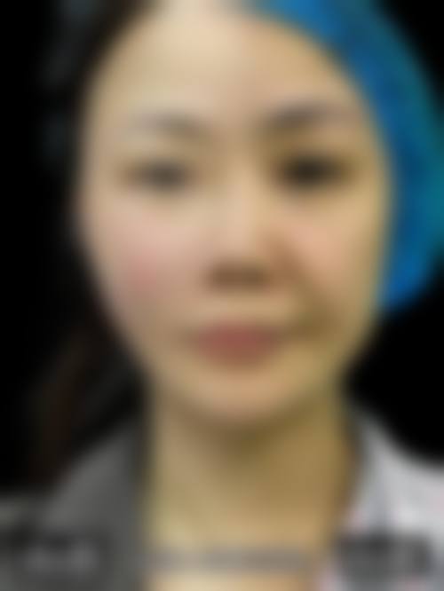 南京欧华医疗美容诊所怎么样求美者反馈