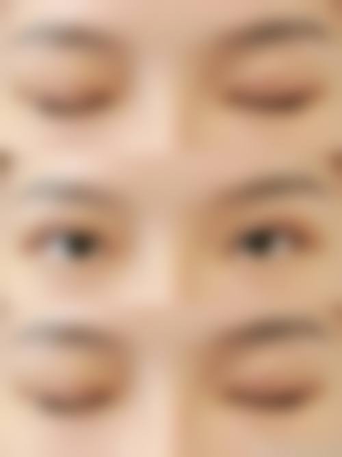 冯晓明医生的临床实例