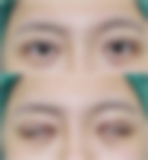 日照仁爱医院医疗美容科怎么样求美者反馈