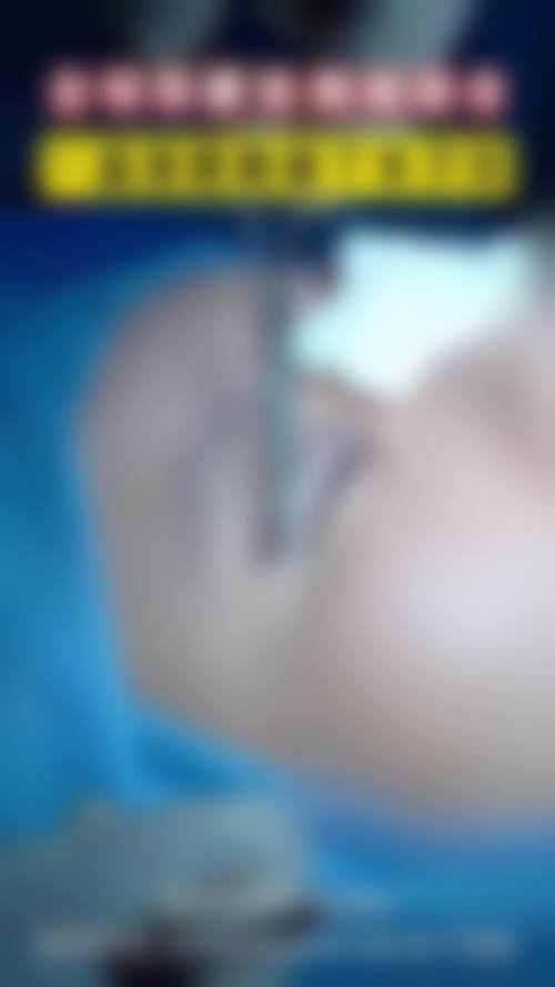 济宁丽珍整形医院怎么样求美者反馈