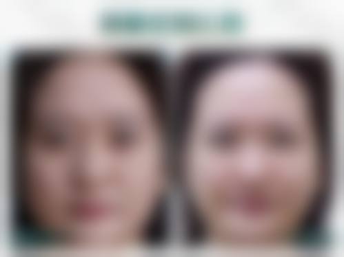 杨兆恩医生的专精素养