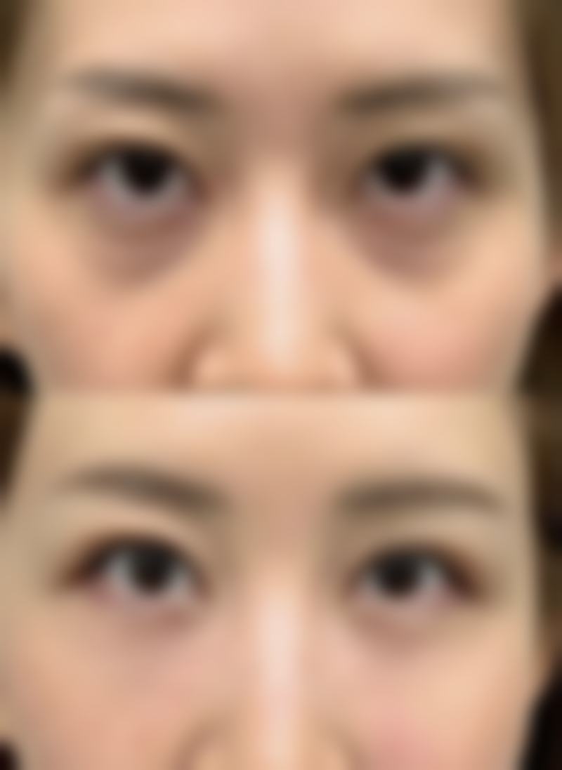 沈阳李梅整形医疗美容诊所怎么样求美者反馈