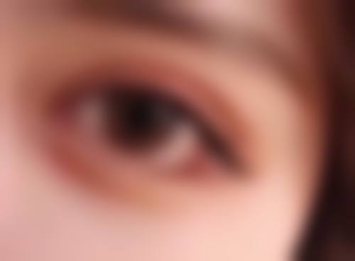 郑娜医生紧跟医美潮流