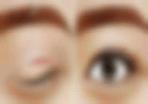 东莞中医和西医结合医院医学整形皮肤美容科怎么样特色项目及技术优势