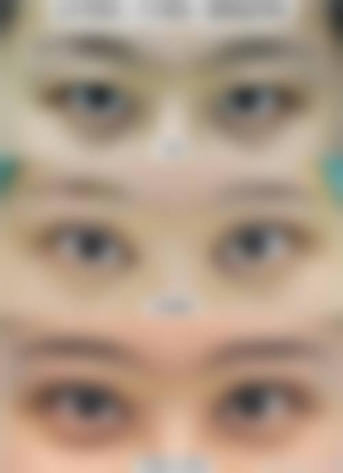 泰国PAI比差審美整形研究所怎么样来院路线