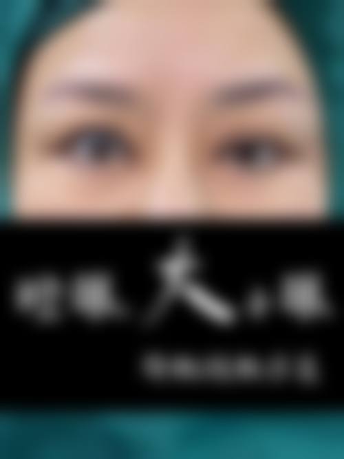 兰宇医生的技术优势