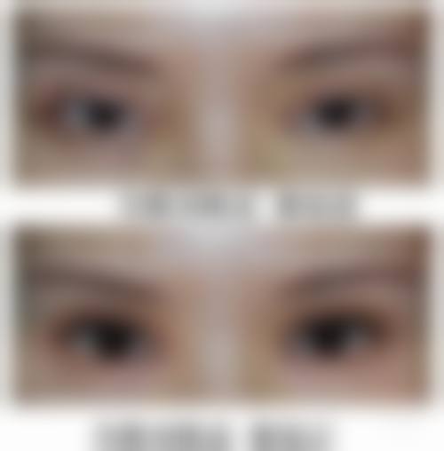 兰宇医生的擅长领域