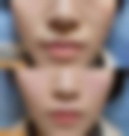 南宁壹莱美整形医院怎么样求美者反馈