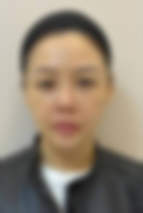 湖北襄阳禾丽积佳医疗美容怎么样医生团队实力