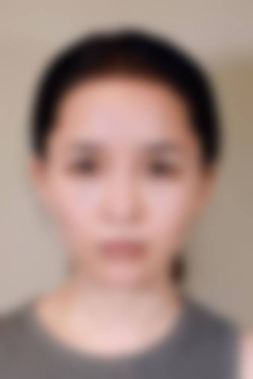 湖北襄阳禾丽积佳医疗美容怎么样求美者反馈