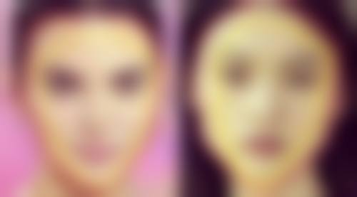 张克昶医生助力美丽蜕变实例