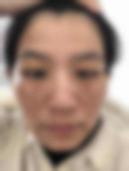 烟台市鹏爱美容整形医院怎么样特色项目及技术优势