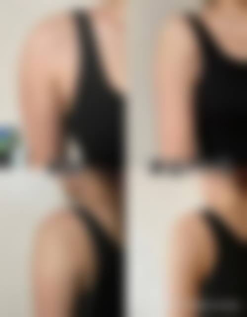 潍坊睿博恩整形医院怎么样特色项目及技术优势