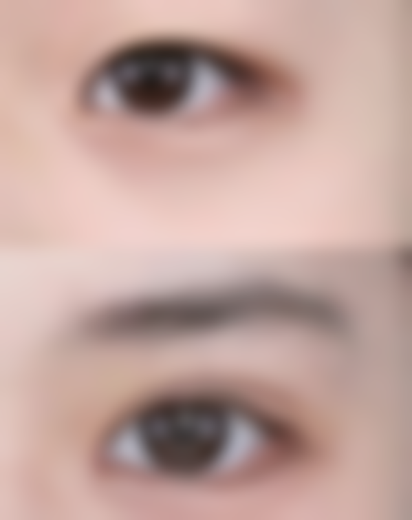 价格与询问,沈文超医生为您答疑解惑