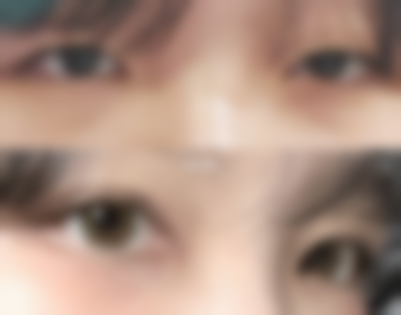 乌鲁木齐花瑟美医疗美容诊所怎么样价格收费