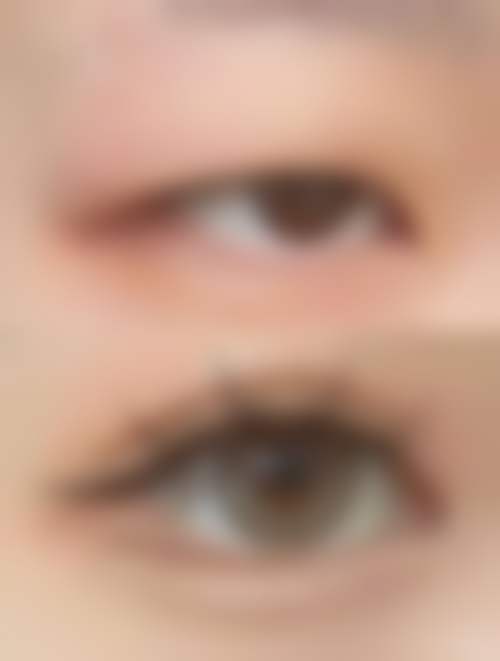 南昌时光整形医院价格收费