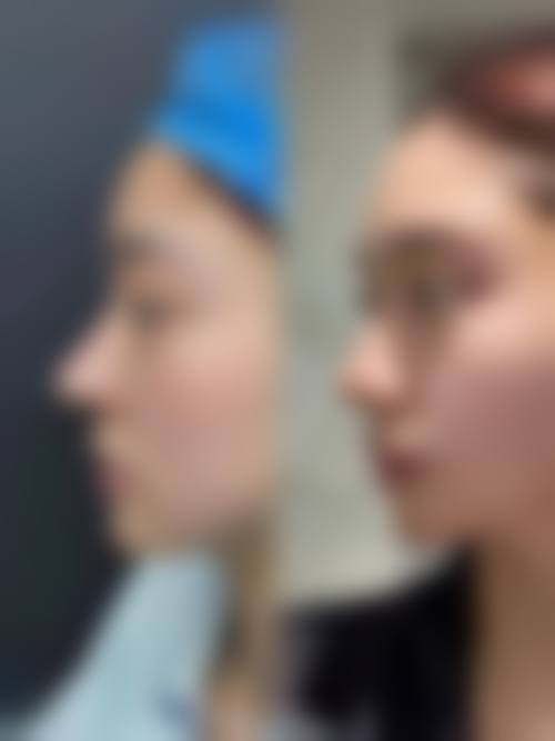 Preecha Tiewtranon 医生的技术特色