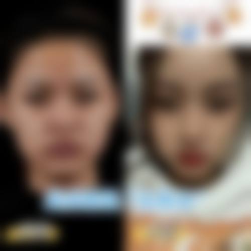 青岛爱美丽整形怎么样特色项目及技术优势