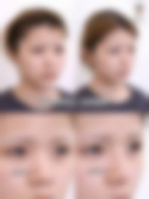 横手美容外科诊所特色项目及技术优势