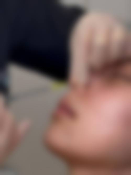 横手美容外科诊所价格收费