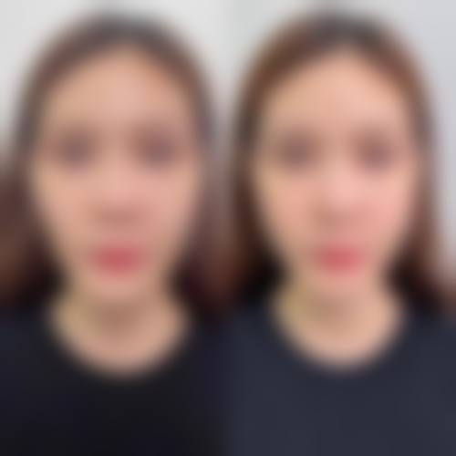 林山医生的价格优势