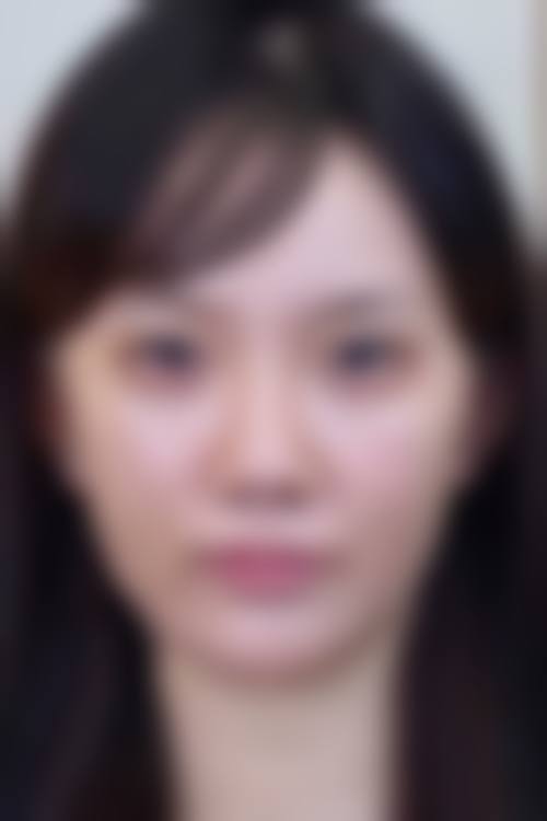 温州市中医和西医结合医院医学美容中 心价格收费