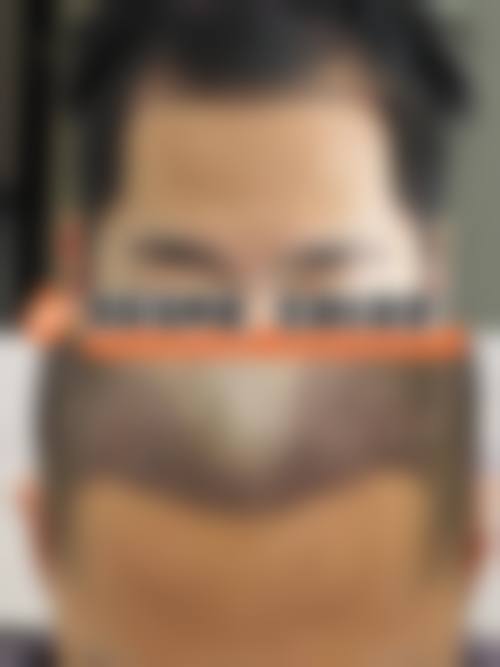 Preecha Tiewtranon 医生的擅长领域