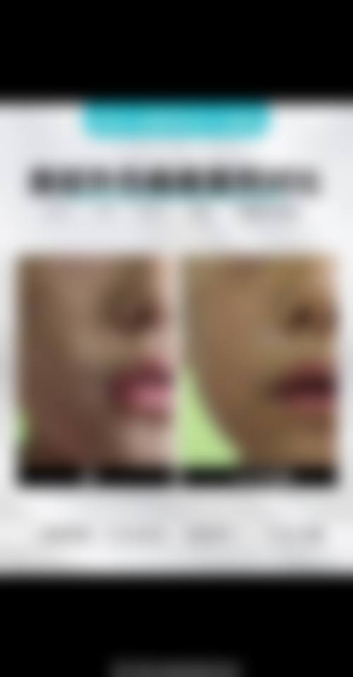 傅勇医生的擅长领域