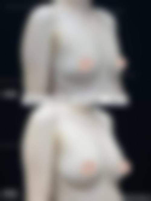 青岛爱美丽整形怎么样价格收费