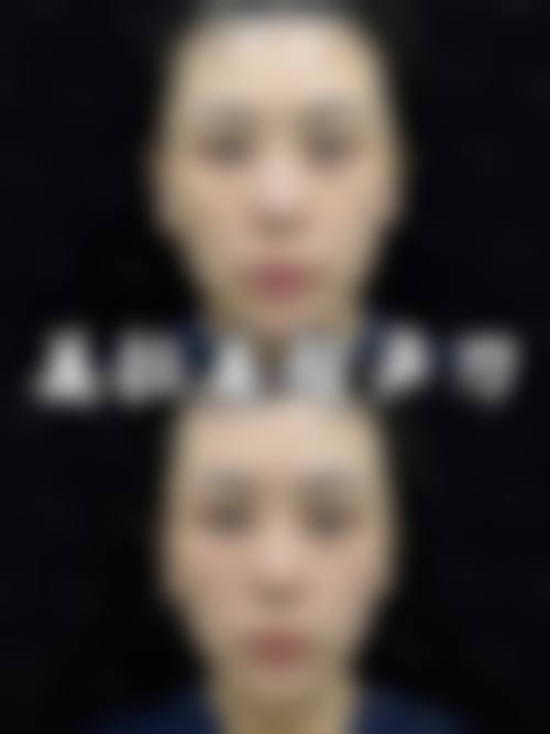 泰安佳美医疗美容怎么样求美者反馈