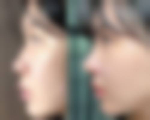 日本譲(让)皮肤科整形外科医院银座院怎么样价格收费