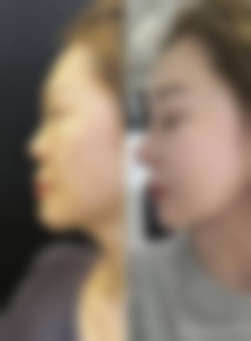 济南雅琪朵医疗美容门诊部价格收费