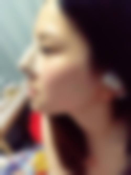 横手美容外科诊所求美者反馈