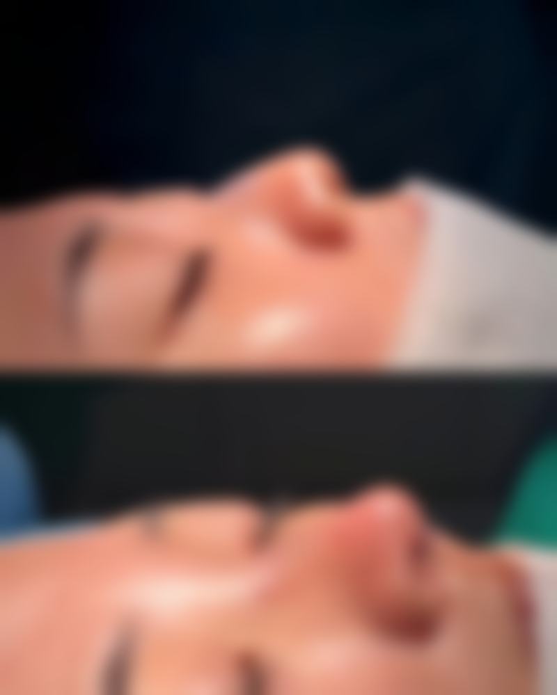 胡顺广医生的临床实例