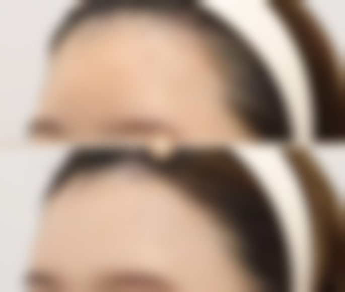 南昌时光整形医院求美者反馈