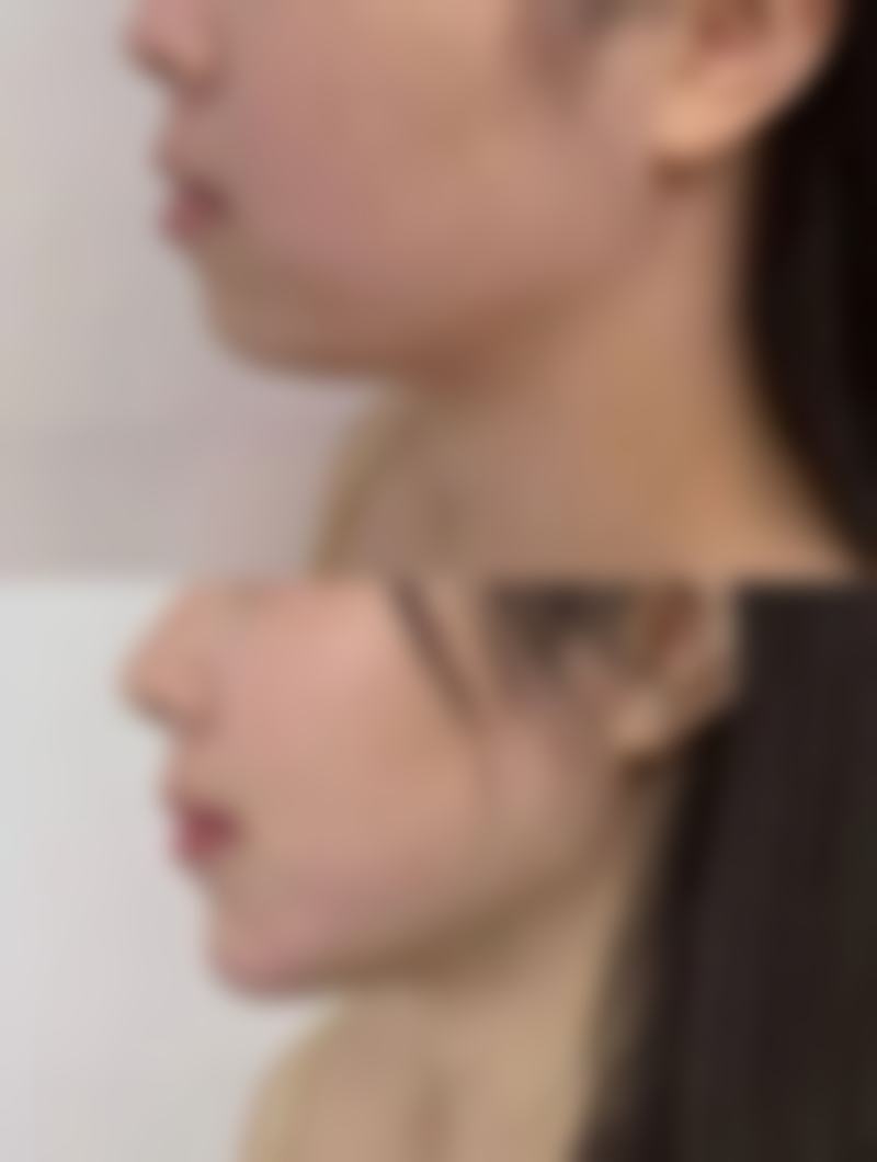 沈阳唯媄晶方医疗美容医院怎么样价格收费