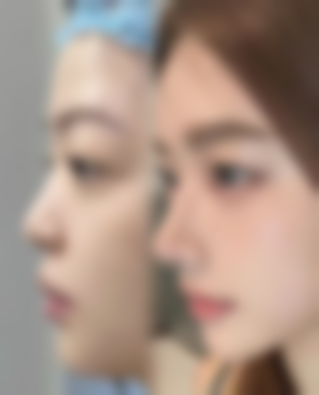 Tegoshi Clinic怎么样求美者反馈