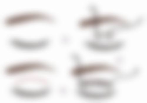 新疆石河子大学医学校第一附属医院整形美容科特色项目及技术优势