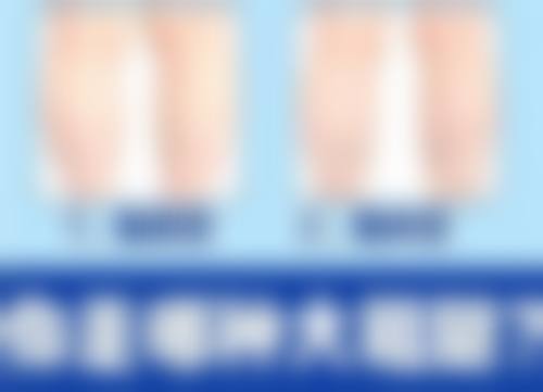 洪剑威医生的贴心服务