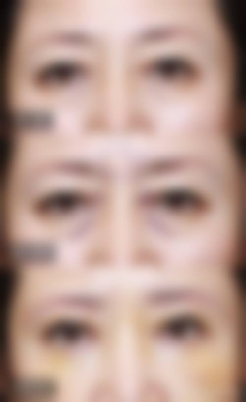 上海陶增莲医疗整形美容诊所求美者反馈