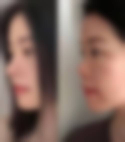 商丘爱艺星整形医院怎么样特色项目及技术优势