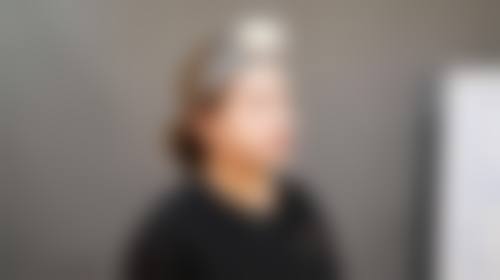 商丘爱艺星整形医院怎么样价格收费