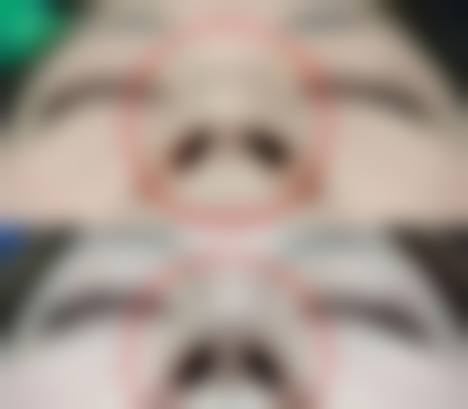 孙玉医生的技术优势