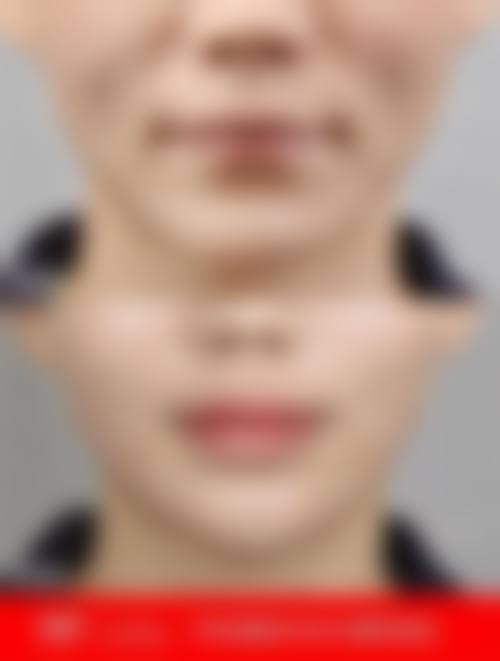 广东佛山顺德亚美医疗美容门诊部医生团队实力