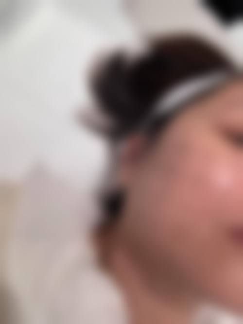 韩国明洞daybeau皮肤科怎么样求美者反馈