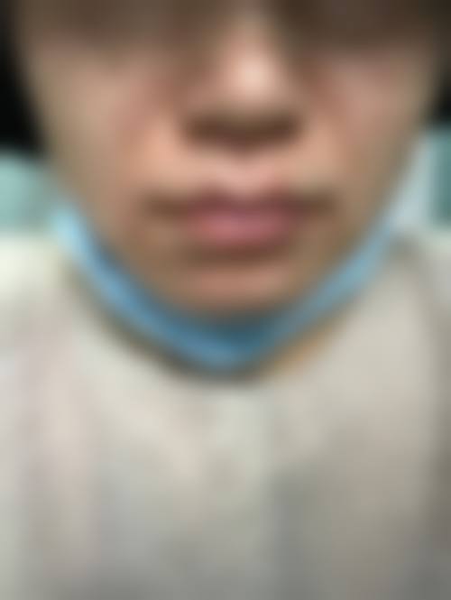 青岛海伦整形美容医院怎么样来院路线