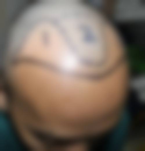 卢丽虹医生的擅长领域