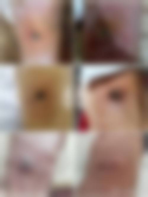 韩国媄潾整形外科医生团队实力