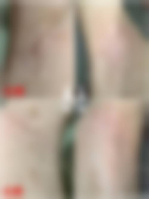 韩国媄潾整形外科求美者反馈