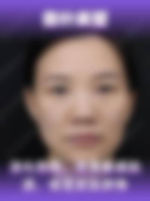 大庆龙南医院医疗美容科怎么样医生团队实力